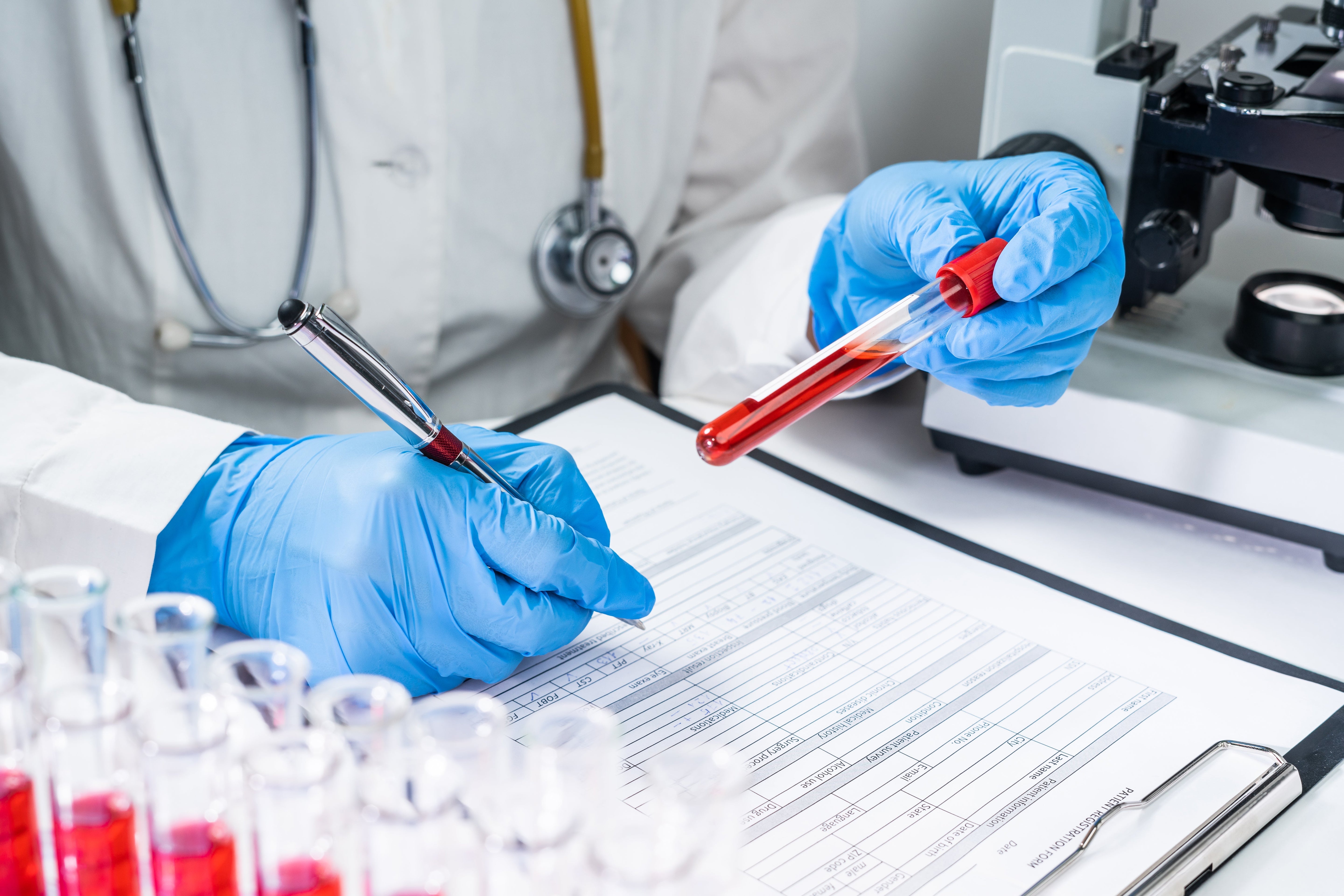 Should You Get Your Vitamin D Levels Tested?