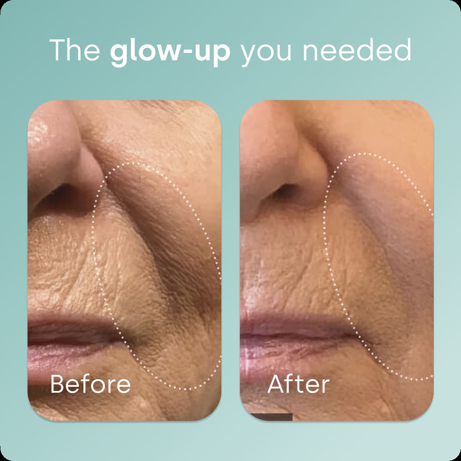 Biosil Advanced Collagen Generator 30 vcap