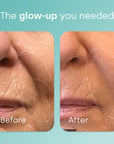 Biosil Advanced Collagen Generator 30 vcap
